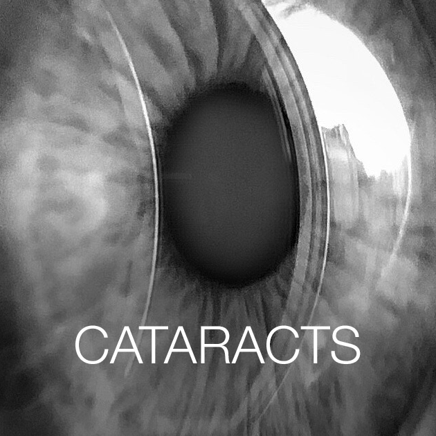 Cataracts Eyecare Virginia Beach 