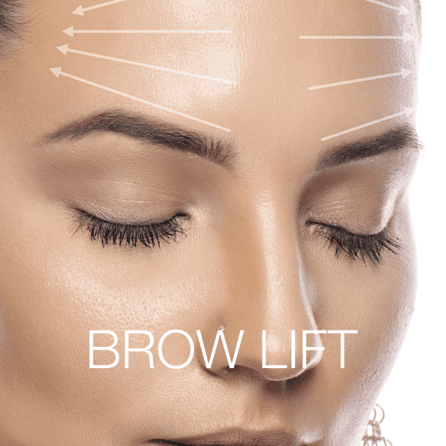 Brow Lift Eyecare Virginia Beach